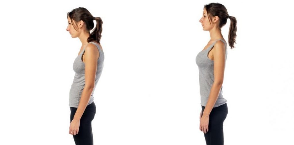 How To Fix Rounded Shoulders And How Long It Takes Good Posture Hq 2766